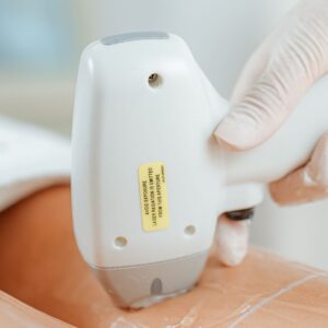 IPL – Achseln