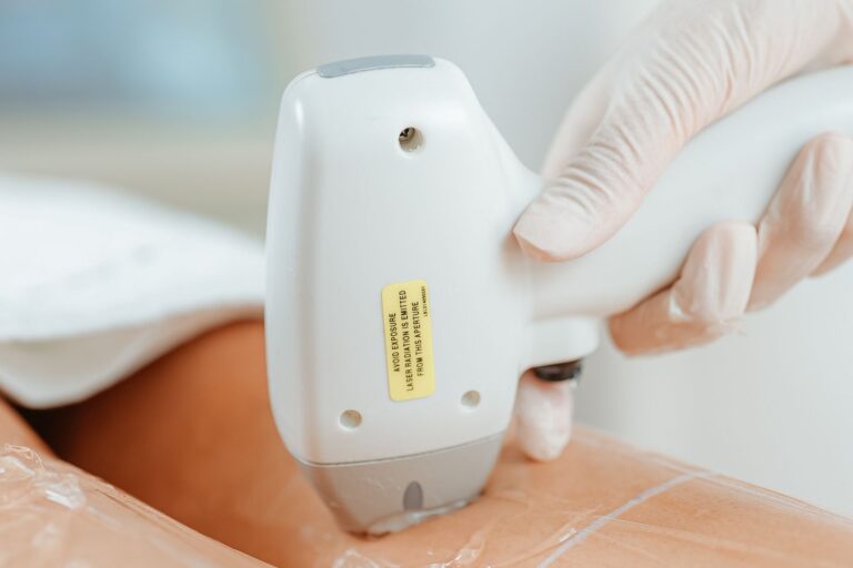 Dauerhafte Haarentfernung mit IPL: wie es wirkt und was realistisch möglich ist