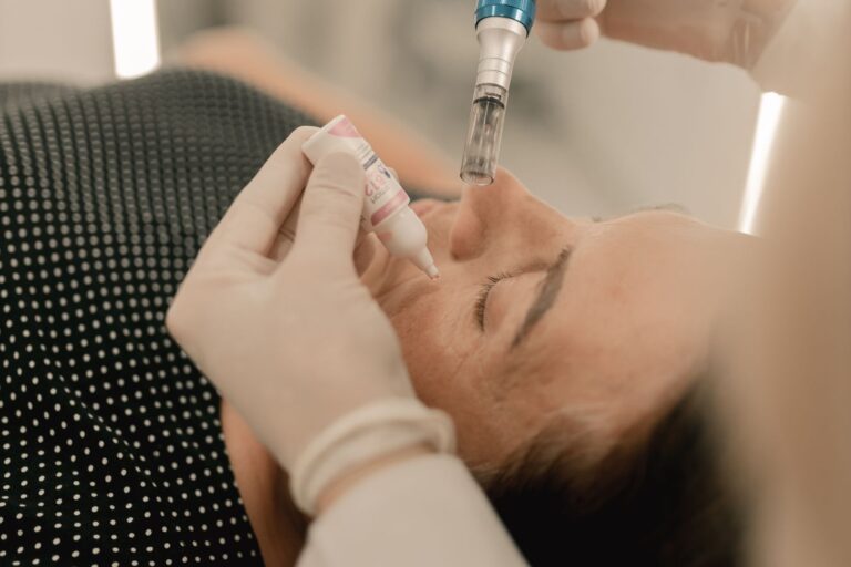 IPL gegen Pigmentflecken und Couperose: was das Licht kann